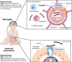 Image result for Group B Streptococcus Prophylaxis