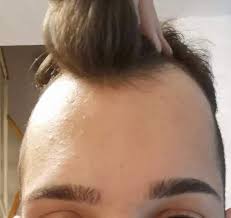 Entdecke eine vielzahl von bildern zum thema kurzhaarfrisuren damen auf pinterest einem tool für visuelle lesezeichen zum entdecken und. Sieht Mein Kopf Hasslich Aus Haare Beauty Aussehen