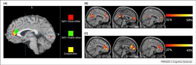 The anterior cingulate cortex can be divided anatomically based on attributed functions into executive (anterior), evaluative (posterior), cognitive. Converging Meta Analyses Showing The Rostral Anterior Cingulate Download Scientific Diagram