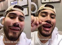 Kevinho, matheuzinho e raí saia rodada se unem em feat. Kevinho Aparece Sem Lente De Contato Nos Dentes E Vira Meme Na Web