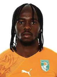 I think he is a quality player, very fast, good tricker, but as the video shows, his finishing ability, that poor finishing ability. Gervinho Hairline And Hair Loss Via Traction Alopecia From Braids Hairstyle