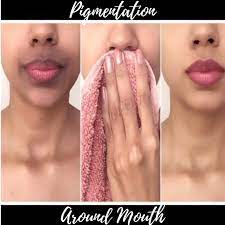 Causes And Remedies For Skin Pigmentation Around The Mouth Natural Hyperpigmentation Treatment Dark Skin Around Mouth Hyperpigmentation Treatment