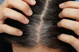 How can you increase the pheomelanin production in your body, while decreasing the eumelanin production? How To Increase Melanin In Hair And Get Rid Of Grey Hair