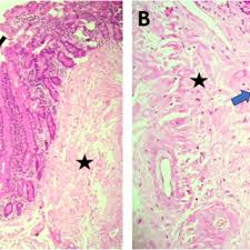 Image result for Liparis killmanniae