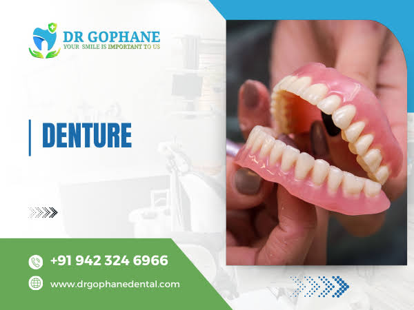 Denture Treatment In Yavatmal product image