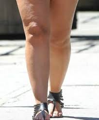 Dressing Tips To Slim Heavy Calves And Ankles Legs Outfit Big Calves Short Women Fashion