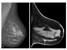 Neue Methoden Fur Ein Optimiertes Screening Drg De