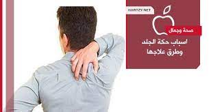 اسباب حكة الجلد وطرق علاجها مدونة هارتزي Health Fitness Nutrition Fitness Nutrition Health Fitness