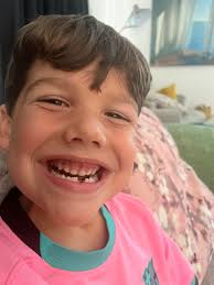 The only time kids smile while bleeding: losing a tooth.