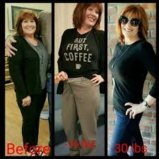 Pin On Before And After Weightloss Stories
