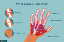 Image result for palm pain when gripping lifting treatment