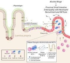 Image result for Intestinal Enteropathy