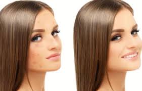 Tache Sur Le Visage Comment Enlever Taches Sur La Peau Naturellement Tout Pratique
