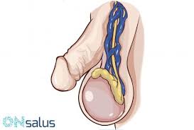 Que Puede Originar Bolitas Linear Unit Los Testiculos Y Como Referirse Bolitas En Los Testiculos Comezon