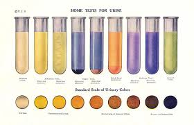 Check spelling or type a new query. Kenali Warna Pada Urine Info Laboratorium Medik