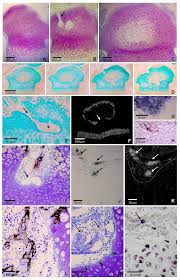 Epiphyseal Line Hi-Res Stock Photography And Images - Alamy