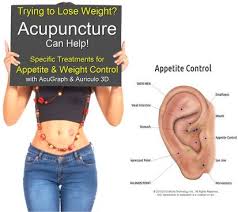 Pin On Ear Acupuncture