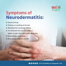 Image result for Neurodermatitis