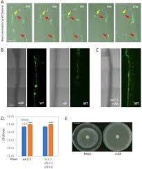 Check spelling or type a new query. Plant Immune System Activation Is Necessary For Efficient Interaction With Auxin Secreting Beneficial Bacteria Biorxiv
