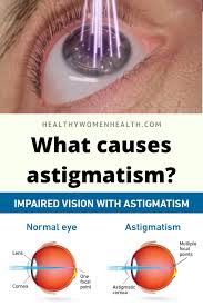 Pin On Eye Health