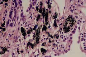 We've gathered our favorite ideas for normal lung histology, explore our list of popular images of normal lung histology photos collection with high resolution. 13 Normal Eye And Ocular Adnexa Histology For Pathologists