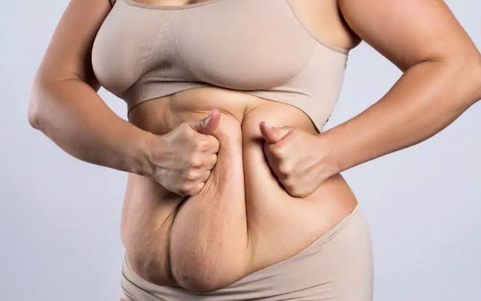 Mini Tummy Tuck vs Full Tummy Tuck-Which Is Right For You | Visage Plastic  Surgery