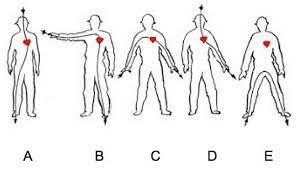 Electrical Shock Hazards Its Effects On Human Body Electrical Technology Human Body Electricity Human