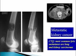 Pin On Radiologia De Mkq