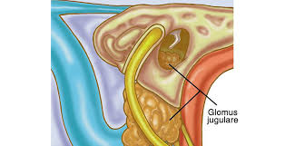 Image result for Glomus tumor
