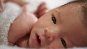 Sakit Mata Pada Bayi Penyebab Gejala Dan Penanganannya