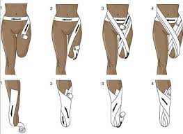 Hesi Case Studies Orthotics And Prosthetics Prosthetic Leg Rehab Nursing