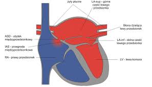 Serial opowiada o sercowych perypetiach jana serce, kanalarza z warszawskiej woli. Serce Trojprzedsionkowe
