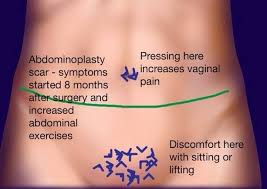 Pin On Female Reproductive Health Disorders
