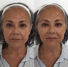 Christine Ibrahim MD, MPH (@drchristineibrahim) · Beverly Hills, CA