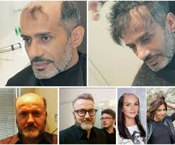 A cesta, g cortellessa, s fratini, a oddi. Simone Fratini On Twitter Capelli For You Come Riavere I Capelli Https T Co Jfcx0tmphp