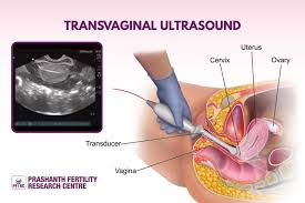 Image result for Ultrasound