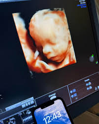 Image result for tbn:T5UajvfpShvp6M::www.photoslinks.com/index.php%3Foption%3Dcom_joomgallery%26func%3Dwatermark%26catid%3D4%26id%3D23%26Itemid%3D2