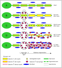 May 03, 2011 · more recently, biologists have discovered that nerve cells probably can regenerate. Wallerian Degeneration The Innate Immune Response To Traumatic Nerve Injury Journal Of Neuroinflammation Full Text
