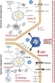 We did not find results for: Frontiers Shedding New Light On Cancer Metabolism A Metabolic Tightrope Between Life And Death Oncology