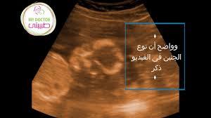 متى و كيف يظهر نوع الجنين لقطات حية للجنين youtube