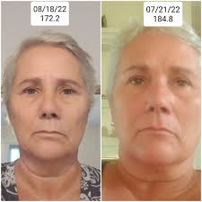 I have lost 12.6lbs in 28 days feeling well, mot bloated, and have been  great to eliminate inflamations