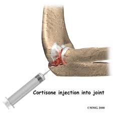Image result for Elbow Injection