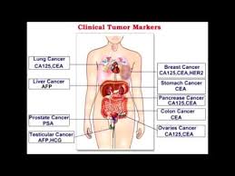 Some tumor markers listed below are targets for targeted therapy in multiple cancers but serve as tumor markers for only a subset of cancers. Tumor Markers Alpha Fetoprotein Beta Hcg Ca 125 Youtube