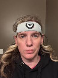 Dr Brian Grosberg talks about the new neuromodulator device for #migraine  by Theranica