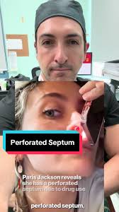 Quick home remedy for Nosebleeds #nosebleed #nose #mom #kids