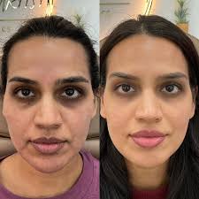 Injector Artist by Heather DeRoche