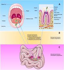 Oral Microbiota A New View Of Body Health Sciencedirect