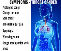 Cancerous tumors of the throat, tongue or voice box (larynx) can cause a sore throat. Throat Cancer Pictures Of Sore Throat Celine Dion Songs Age