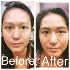 CP Skincare, 9111 S Lost Hill Dr, Lone Tree, CO 80124, US