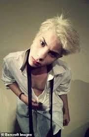 Meet Leo Blanco, The Boy Who Did Surgery To Look Like Micheal Jackson, See  How He Was Before Surgery